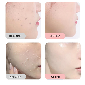 <span class=keywords><strong>Exfoliante</strong></span> Facial Personalizado con Logotipo, Limpiador, Hidratante, Iluminador, con Rosa, Té Verde, Cúrcuma, Coco y <span class=keywords><strong>Fresa</strong></span>, <span class=keywords><strong>para</strong></span> el Cuidado <span class=keywords><strong>de</strong></span> la <span class=keywords><strong>Piel</strong></span> - Product Image 4