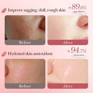 <span class=keywords><strong>Mascarilla</strong></span> Facial FAYANKOU <span class=keywords><strong>de</strong></span> <span class=keywords><strong>Aguacate</strong></span>, Fresa, Melocotón, Aloe y Rosa, Mascarillas Faciales Hidratantes Naturales <span class=keywords><strong>para</strong></span> el Cuidado <span class=keywords><strong>de</strong></span> la Piel <span class=keywords><strong>de</strong></span> la Mujer - Product Image 6