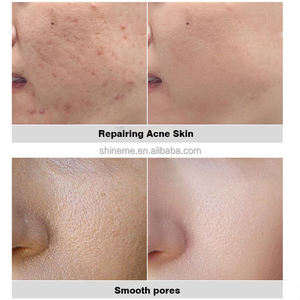 OEM ODM 5ml ไวท์เทนนิ่งทรีทเมนต์รักษาสิวเมลาสม่าฟองน้ำเซลล์ผิวเปลือก Microneedle สารสกัดจากสาหร่าย - Product Image 6