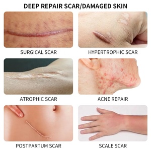 Oem surguérison kéloïde boutons du visage naturels élimination des cicatrices réparation des vergetures élimination de la crème pour les vieilles cicatrices - Product Image 6