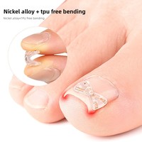 Correcteur d'ongles incarnés, attelle de correction pour ongles incarnés, clip de redressement d'ongles, patch de récupération