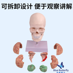 Modèle de crâne humain, crâne naturel de grande taille avec vertèbres cervicales et excroissances, modèle d'artères crâniennes et cérébrales avec support. - Product Image 1