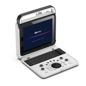 Портативный цифровой ультразвуковой аппарат - Product Image 2