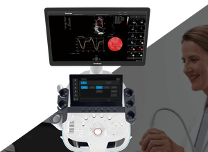 Sistema de Diagnóstico por Ultrasonido Doppler Digital de Alta Calidad Sonoscape P12 Elite con Imagen I+Scan para Humanos/Hospitales/Clínicas - Product Image 6