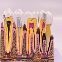 Modèle de squelette dentaire humain pathologique, modèle d'affichage de la cavité buccale, modèle pédagogique pour les sciences médicales Tianlian TL-JX022