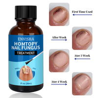 Huile de traitement des ongles fongique des pieds pour la réparation des pieds, sérum pour les ongles des orteils abîmés