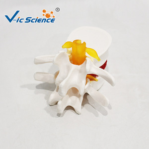 Modelo de demostración de hernia de disco lumbar, esqueleto vertebral espinal médico, material didáctico de patología, venta al por mayor desde - Product Image 5