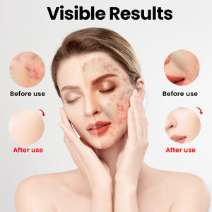 IDEATHERAPY TLM200-K Triple-Puce <span class=keywords><strong>Masque</strong></span> de beauté en silicone de qualité médicale Thérapie par la lumière infrarouge <span class=keywords><strong>Masque</strong></span> de lumière rouge <span class=keywords><strong>Masque</strong></span> de thérapie par la lumière rouge - Product Image 3