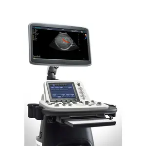 Instrumen Ultrasound Medis 3d/4d Teknologi Tinggi Troli Ultrasonik Lainnya Ultrasound Warna dengan Elastograf Sonoscape S22