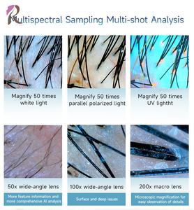 2025 professionnel AI technologie cheveux cuir chevelu Scanner détecteur 3D analyse de la peau avec stockage de données en nuage pour US EU JP IT Plug Types - Product Image 2