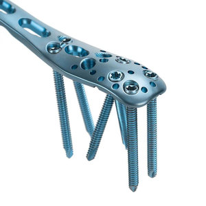 Stainless Steel Manual Reusable Lightweight Hot Selling Orthopedic Best Selling Wholesale Surgical Instruments - Product Image 2