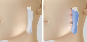Gel di Silicone <span class=keywords><strong>Trasparente</strong></span> Adesivo Come Trattamento per Appiattire e Levigare Cicatrici e Cheloidi Campione Gratuito - Product Image 6
