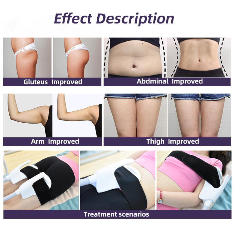 Tesla Ems Slimming Machine Manufacturer From China