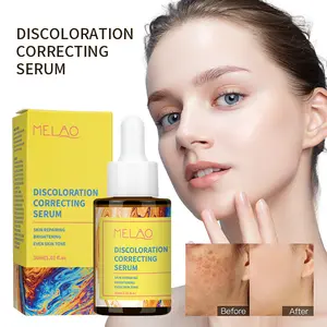 30ml Verfärbung korrektur serum für dunkle Flecken Sonnens chäden und Alters flecken Hautpflege Gesicht und Körper