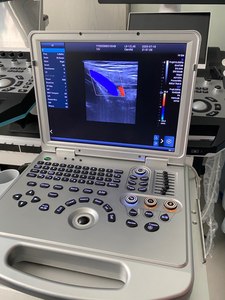 Ecógrafo Doppler Color Portátil de Alto Rendimiento Dawei DW-L3, Diseño Tipo Laptop para Diagnóstico en Hospitales Primarios - Product Image 2