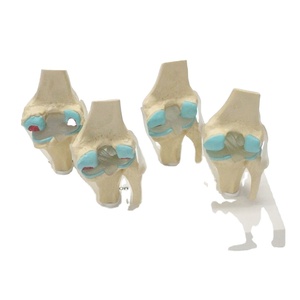 Artrose Kniegewricht <span class=keywords><strong>Model</strong></span> Frt033 Levensgrote Transparante Ligament 4 Stadium Pathologische Ontwikkeling Medisch Anatomisch <span class=keywords><strong>Model</strong></span> - Product Image 1