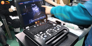 SUN-906A Sistema de Ultrasonido Veterinario Doppler Color Portátil con Pantalla LCD de Alta Resolución para Clínica Veterinaria - Product Image 6