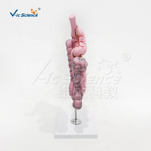 Modelo <span class=keywords><strong>de</strong></span> Enfermedad del Sistema Digestivo <span class=keywords><strong>de</strong></span> PVC, 2 Partes Desmontables, Estómago para Enseñanza <span class=keywords><strong>de</strong></span> Patología, CE ISO ROHS CNAS - Product Image 5