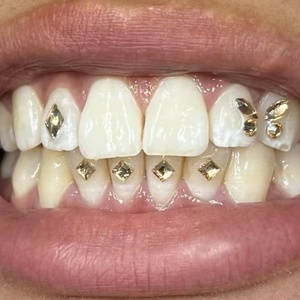 Giá tốt nhất New phong cách pha lê chì miễn phí hoặc Swarovski sprinkless răng đá quý Starter Kit là rất phổ biến hiện nay - Product Image 2