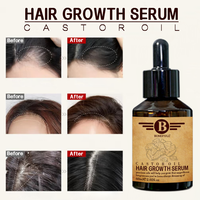 Huile capillaire naturelle à base de gingembre pour femmes et hommes - Prévention de la perte de cheveux et traitement de la croissance des cheveux - Utilisation à domicile - Formule 2-en-1