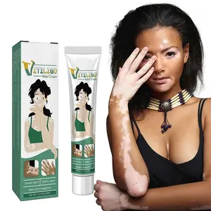 Groothandel Kruidenextract Vitiligo Behandeling Zalf Ringworm Witte Vlek Verwijdering Huid Vitiligo Elimineren Vitiligo Crème
