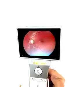 Super Quality Hand Held Retinal Fundus Camera New with Compact and portable features for ophthalmic equipment eye exam