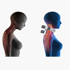 Moxibustion à plusieurs têtes, compresse chaude, <span class=keywords><strong>médecine</strong></span> chinoise, bâton de moxibustion, feuille d'armoise, soulagement de <span class=keywords><strong>la</strong></span> douleur, certifié de classe II, SG-A110 - Product Image 5