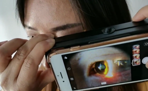 Nouvelle Lampe à Fente Numérique Ophthalmique Ultra-Portable à Main, Compatible Smartphone, Grossissement 6X - Prix - Product Image 2