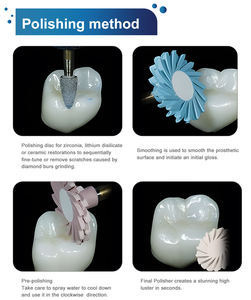 Kit Elettrico per la Regolazione del Composito Dentale con Dischi Flessibili per Denti Anteriori/Posteriori, Materiale per Protesi - Product Image 3
