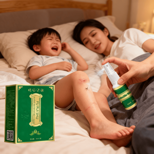 शक्तिशाली एंटी एलर्जी खुजली राहत स्प्रे वसंत पराग एलर्जी राहत तेजी से परिवार सार्वभौमिक आपातकाल को कम करती है - Product Image 6