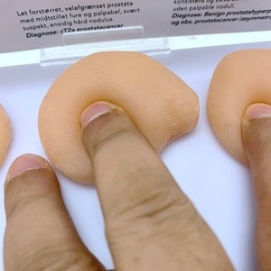 Modelo Anatómico de Tumor Prostático Humano para Ciencias Médicas, Modelo de Anatomía Humana - Product Image 4