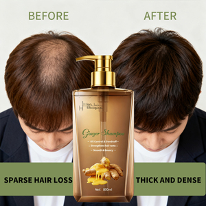 Champú de jengibre de calidad superior 800 ml Paquete familiar grande Cuidado general del cabello Nutre el cuero cabelludo Mantiene el cabello suave y manejable - Product Image 2