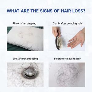 JMFREE ผลิตภัณฑ์ขาย<span class=keywords><strong>ส</strong></span>่ง ป้องกันผมร่วง กระตุ้นการงอกใหม่ บำรุงและฟื้นฟูเส้น<span class=keywords><strong>ผม</strong></span> โฟมไบโอติน ช่วยเร่งการเจริญเติบโตของเ<span class=keywords><strong>ส</strong></span>้น<span class=keywords><strong>ผม</strong></span> - Product Image 3