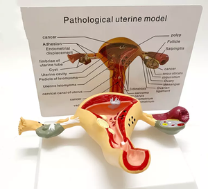 Modèle anatomique de l'utérus <span class=keywords><strong>humain</strong></span> en PVC de haute qualité, structure pathologique gynécologique, organes reproducteurs féminins pour l'enseignement CE/ISO - Product Image 3