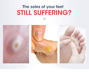 แผ่นแปะขจัดหนังด้าน MQ สูตรจีน 100% จากธรรมชาติ ได้รับการรับรองมาตรฐาน CE ระดับ I ของใช้จำเป็นในชีวิตประจำวัน ใช้งานง่าย สำหรับหนังด้านและตาปลา - Product Image 6