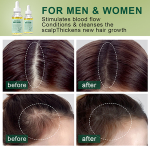 Natuurlijke 100% Pure Etherische Olie 60Ml Rozemarijn Blad Olie Haaruitval Verzorging Rozemarijn Haargroei Etherische Olie - Product Image 3