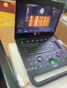 Mesin <span class=keywords><strong>Ultrasound</strong></span> PW kinerja tinggi SUN-800C hemat biaya untuk klinik spesialis Rumah Sakit Umum - Product Image 2