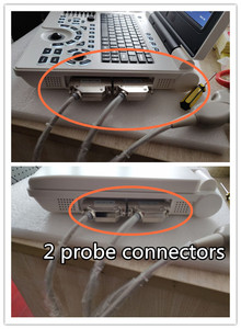 Machine à ultrasons JM-806H Chine Meilleur fabricant Portatil Ultrason pour ordinateur portable - Product Image 3