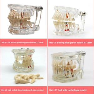 Modelo de Enseñanza Dental para la Comunicación Médico-Paciente, Restauración de Implantes Dentales <span class=keywords><strong>Removibles</strong></span>, Uso Clase I - Product Image 4