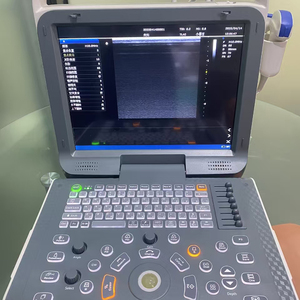 Máquina de Ultrasonido Doppler a Color Portátil, Plataforma ARM, Computación Rápida para Diagnóstico Humano y Veterinario, Acero Inoxidable, 3 Años de Garantía - Product Image 4