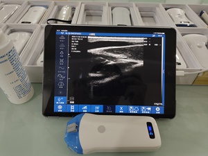 Sonde sans fil DMU42 à 128 éléments, 10-14 MHz, sonde Doppler linéaire haute fréquence pour échographie MSK et examen superficiel - Product Image 4