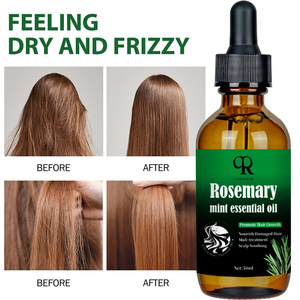 100% doğal formülü besleyici kafa derisi Elixir biberiye yağı saç bakımı kaybı tedavisi saç büyüme yağı serumu - Product Image 6