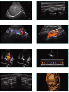 Promotion <span class=keywords><strong>Sonoscape</strong></span> <span class=keywords><strong>S11</strong></span> Plus Système d'échocardiographie 3D 4D Chariot Échographe Doppler couleur pour hôpital - Product Image 5