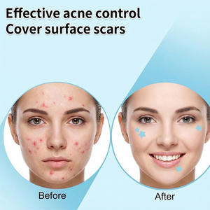 Patchs anti-acné pour le visage pour femmes, vente en gros OEM, marque privée, best-seller, patchs invisibles absorbant les boutons, pour une peau claire - Product Image 6