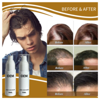 Liquide volumateur pour cheveux de barbier 30 ml, liquide de retouche pour cheveux, imperméable, correcteur de cheveux pour hommes, liquide longue durée 3 à 7 jours, personnalisable