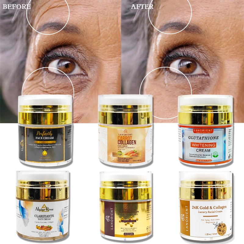 china glutathione whitening cream Private Label Lanorient Korea Skin Care Products Natural Organic Vitamin C Skin Moisturizing Face & Lotion Pack:1 a) Illustration of Cu Mature skin