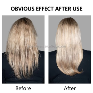 Champú Nutritivo Antifúngico con Aceite <span class=keywords><strong>de</strong></span> Árbol <span class=keywords><strong>de</strong></span> Té <span class=keywords><strong>de</strong></span> Marca Privada OEM para Psoriasis del Cuero Cabelludo, Foliculitis y Dermatitis Seborreica, Eficaz - Product Image 5