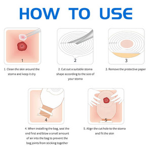 Một mảnh drainable xử lý không dệt vải stoma túi chứa chất thải Túi thoát nước loại một mảnh chứa chất thải Túi - Product Image 5