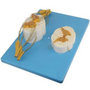 KyrenMed Modelo de Columna de Soporte para Médula Espinal <span class=keywords><strong>y</strong></span> Sistema Nervioso Periférico 5X Veces - Product Image 2