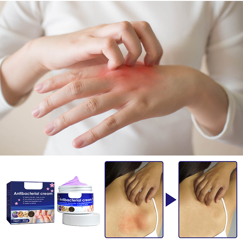violet divine skin itching cream skin itching and itching relief mosquito bites topical cream